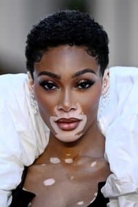 Winnie Harlow profile